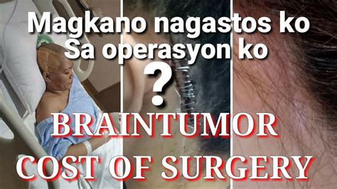 Magkano ang operasyon sa appendix